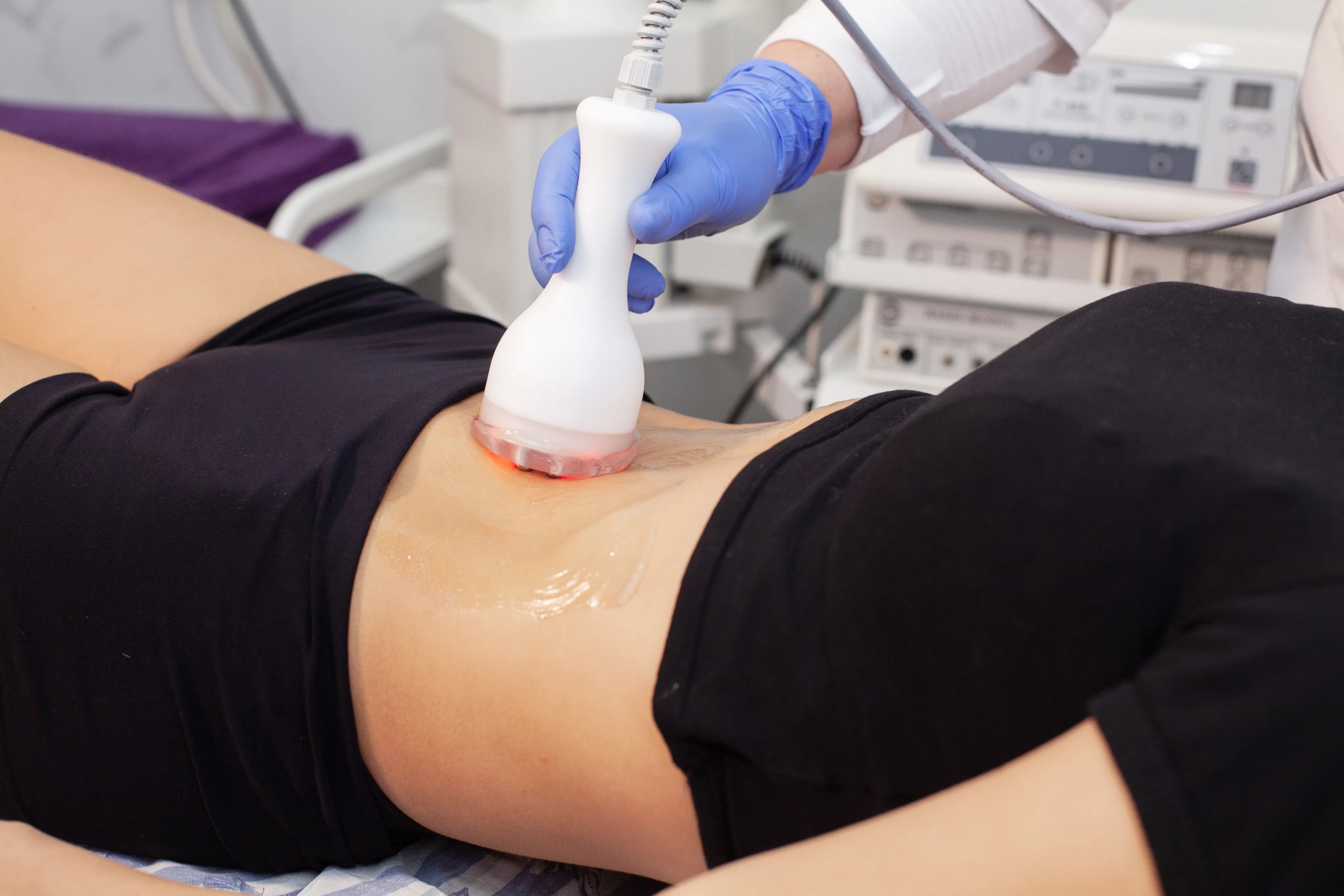 Application d'un embout médical sur l'abdomen d'une patiente allongée